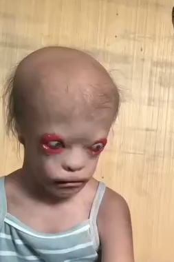 Let's Help Alexandra Blink Again