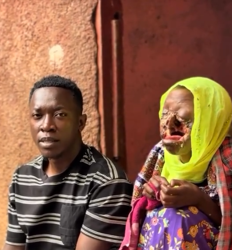 Help Us Fund Critical Reconstructive Surgery For Zahra