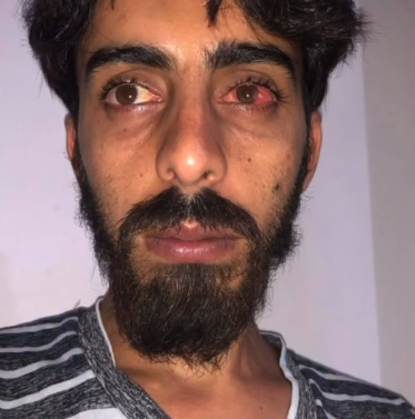 Let's Help Jehad Fund His Life Changing Eye Surgery