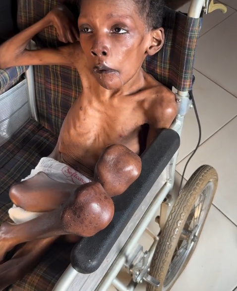 Help Us Provide Ian With Vital Medical Help And Urgent Nutrition
