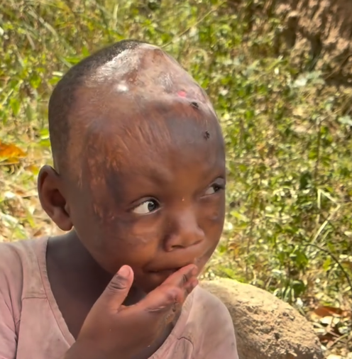 Let's Help Fund Critical Skull Surgery For Brave Winnie