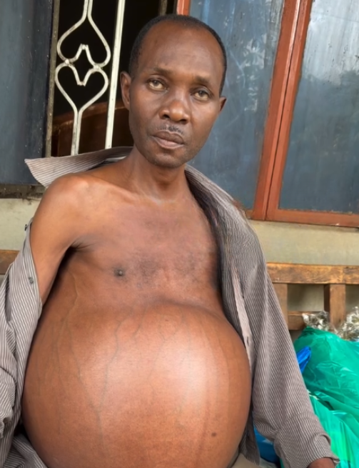 Let's Help Doctor Dickens Afford a Life Saving Liver Transplant