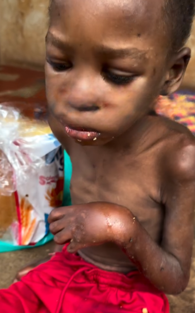 Help Us Provide Vital Medical Care And Nutrition For Tom To Recover