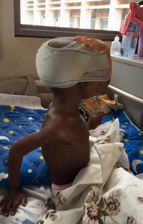 Let's Help This Tiny Fighter Access Urgent Surgery And Essential Medical Care