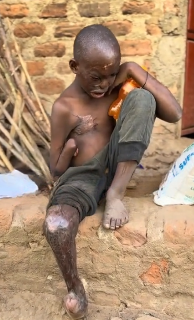 Help Us Fund Critical Medical Relief And Skin Treatment For A Child In Need