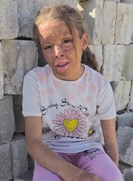 Help Us Provide Food and Water to Help Amina Survive