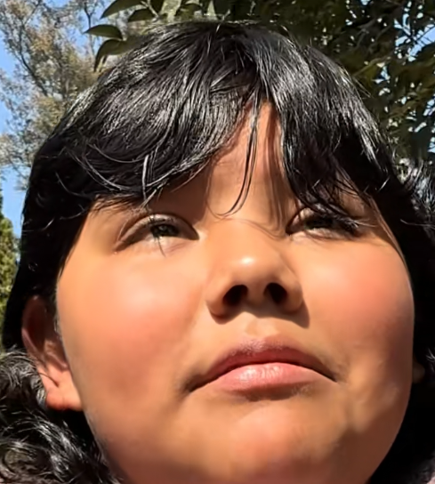 Help Us Fund Luna's Life Saving Transplant And Treatment